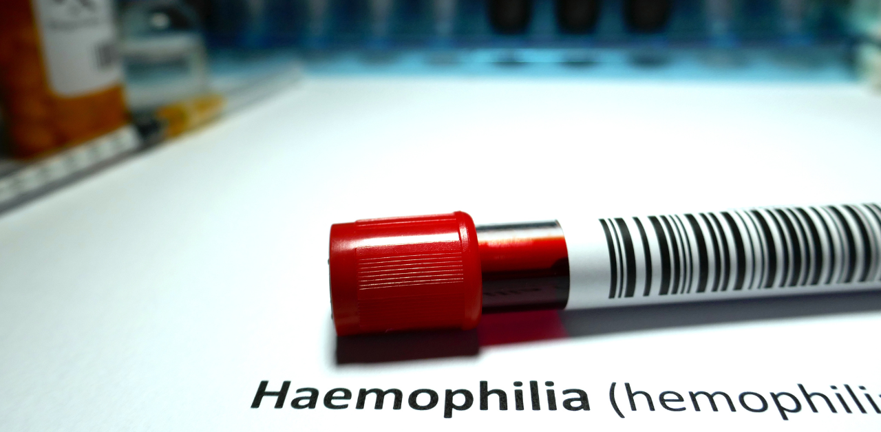 QFITLIA (fitusiran): A New Treatment for Hemophilia A and B Approved by the FDA on March 28, 2025