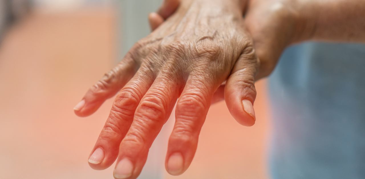 Nerve pain, hand pain