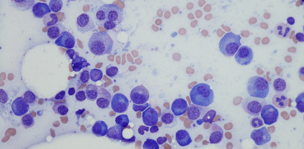 FDA Approves Elrexfio for Multiple Myeloma on August 14, 2023