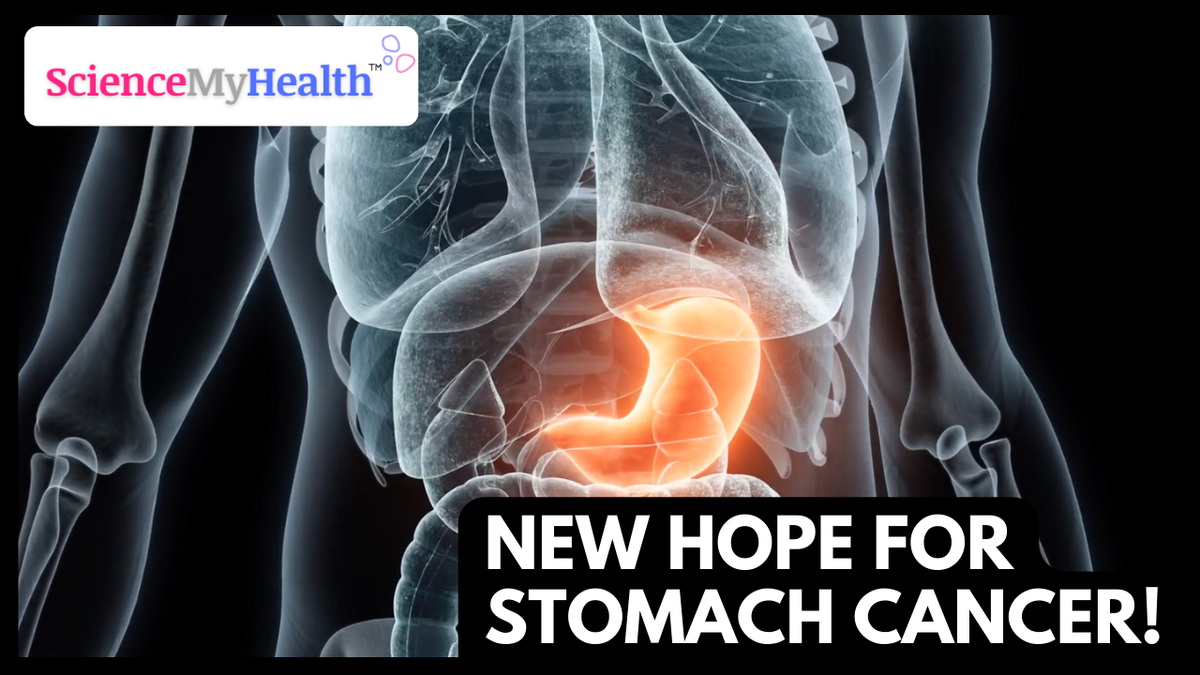 New Hope for Stomach Cancer: Combining Immunotherapy and Chemotherapy Before Surgery